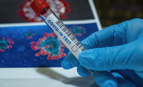 В Запорізькій області знов виявляють хворих на коронавірус