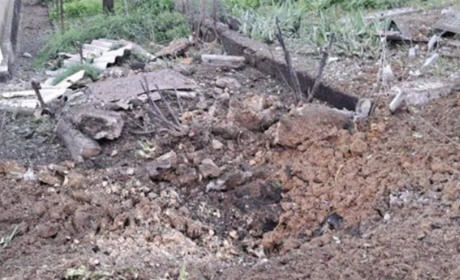 Наступив на міну: чоловіку відірвало ногу на зупинці під Херсоном