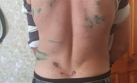 У Білопільському дитячому будинку-інтернаті б'ють підопічних? Що виявила моніторингова перевірка?