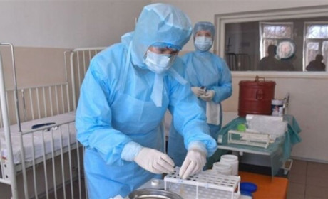 В області за добу 294 хворих