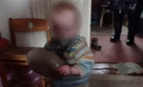 У шосткинки вилучили трьох дітей, за якими вона не доглядала. Малеча - у лікарні