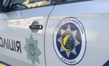 Вдарив ногою в обличчя: на Житомирщині вітчим травмував 7-річного пасинка через злість на дружину