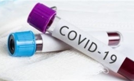 COVID-19: в Україні – понад 15 тисяч за добу, в області – майже 550. Додалося хворих і  у місті