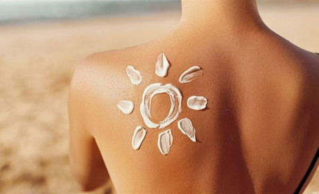 Що робити у разі опіків від сонця і вогню: пояснює МОЗ