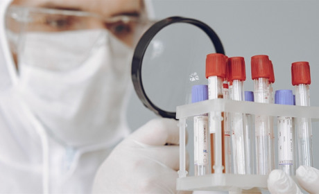 В Запоріжжі дві смерті від коронавірусу за два дні, а країна чекає на пом’якшення карантину