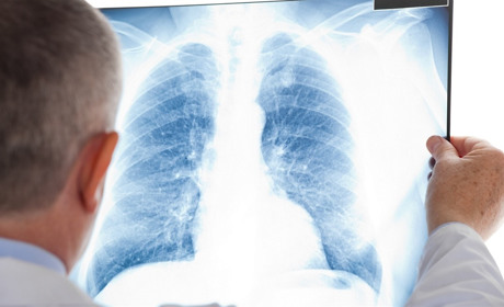 В Україні за добу одужала рекордна кількість осіб — 1016. А яка ситуація в Мелітополі та в області?