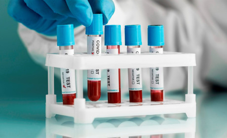 Коронавірус у Сватівському районі: статистика поширення COVID-19 на 2 листопада 2021