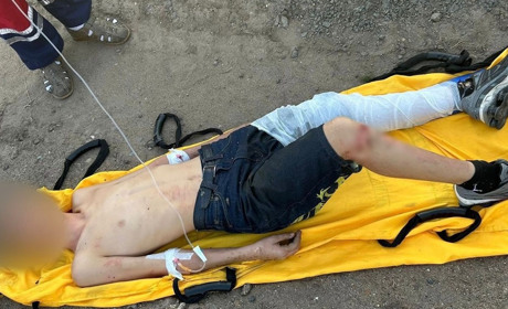 Двох підлітків в Одеському районі вдарило струмом: вони залізли на залізничний вагон