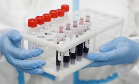 Ситуація з коронавірусом на 6 липня: у Вараші 151 випадків захворювань, на Володимиреччині – 110