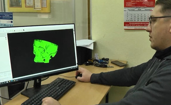 В Мариуполе печатают 3D-модели костей и органов. Они помогают врачам при операциях (и не только)