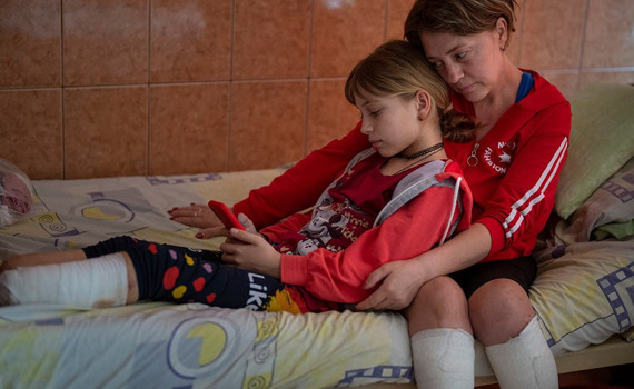 Я просто дуже хочу бігати. 11-річна дівчинка та її мама втратили кінцівки на вокзалі Краматорська