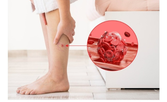 Захворювання вен: причини, прояви та профілактика