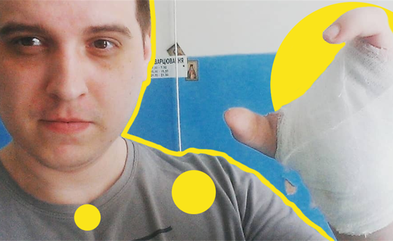 Почему переселенец из Донецка пришел на телевидение за новой рукой и что из этого получилось