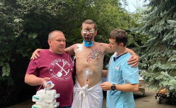 Демінер Владислав Єщенко втратив зір та слух на фронті. Тепер він бореться за своє здоров'я