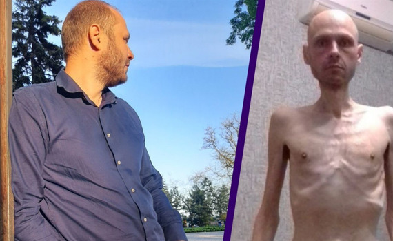 Місяць тому Володимир Цема-Бурсов повернувся з полону. Майже за 2 роки чоловік схуд на 38 кілограмів