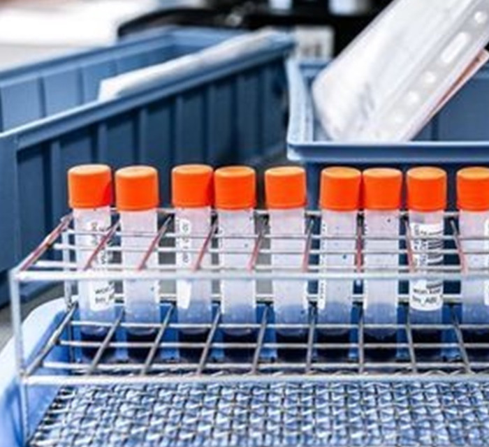 Луганская область во второй половине марта получит тесты на определение коронавируса