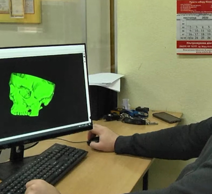 В Мариуполе печатают 3D-модели костей и органов. Они помогают врачам при операциях (и не только)