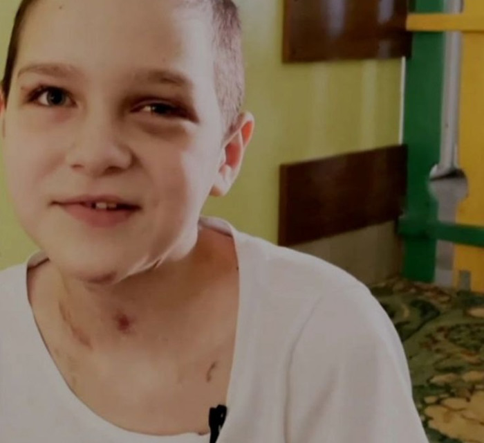 В Угледаре снаряд попал в подвал, где пряталась семья. 10-летняя Вероника ранена и осталась сиротой