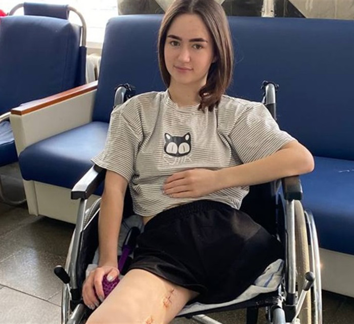Мам, а ноги уже нет. 19-летняя студентка Анастасия пострадала во время ракетного удара в Краматорске