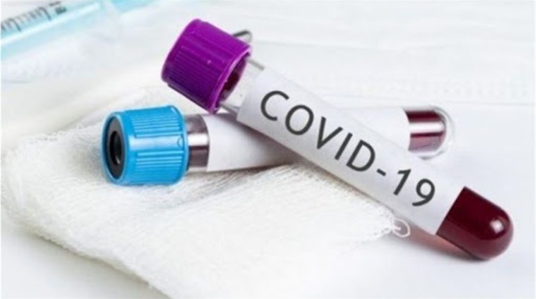 COVID-19: Нетішин перетнув позначку 400. За попередню добу статистика знову невтішна