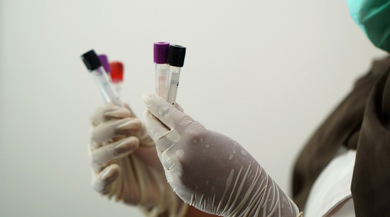 У Сватівському районі +13 хворих на COVID-19: яка ситуація з поширенням коронавірусу на Луганщині