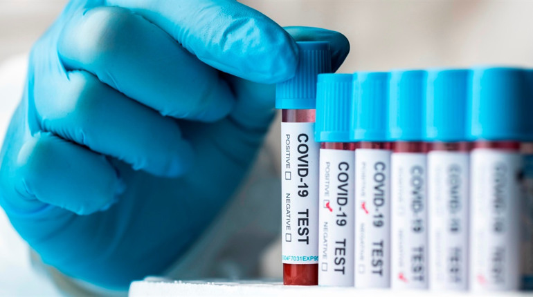 COVID-19 в Україні: яка ситуація з поширенням коронавірусу на Сватівщині і у Луганській області
