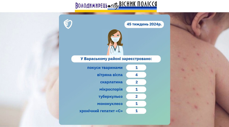 У Вараському районі за тиждень – найбільше випадків віспи