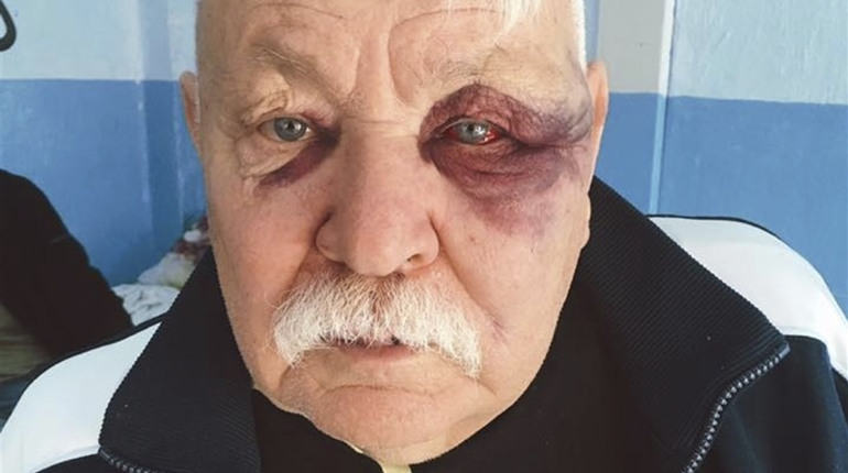 У Жмеринці скандал: чому побилися водій автобуса і пенсіонер