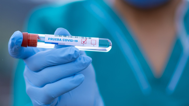 В Україні за добу COVID-19 підтвердили у 328 людей: яка ситуація на Луганщині і Сватівщині