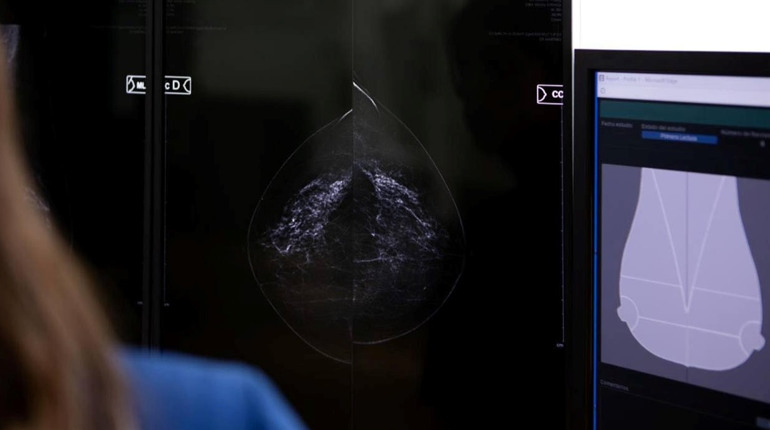 У Сарнах знову працює мамологічний кабінет: як пройти огляд