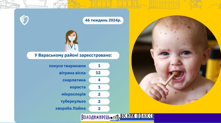 У Вараському районі "лідирує" віспа: статистика тижня