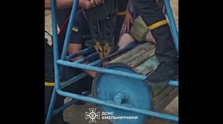 У Нетішині надзвичайники звільнили дівчинку, нога якої застрягла у спортивному тренажері