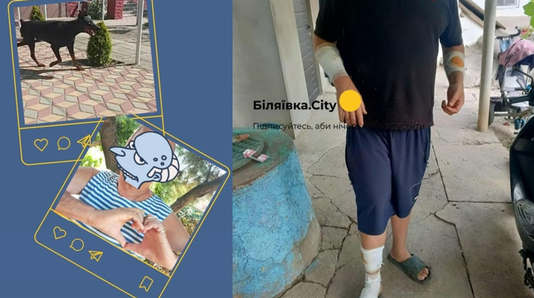 Чоловік закрив собою дитину, рятуючи від собаки в Біляївці. Власник нічим не допоміг