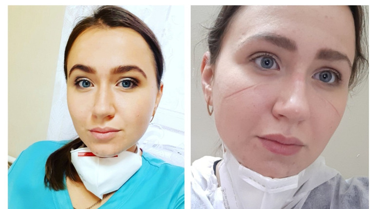 100 дзвінків щодня, 12 годин на ногах, цілодобово на зв'язку: лікарка-інфекціоністка про роботу
