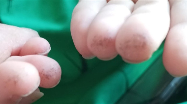 Допоможемо родині з Первомайська: необхідна система моніторингу глюкози для дитини