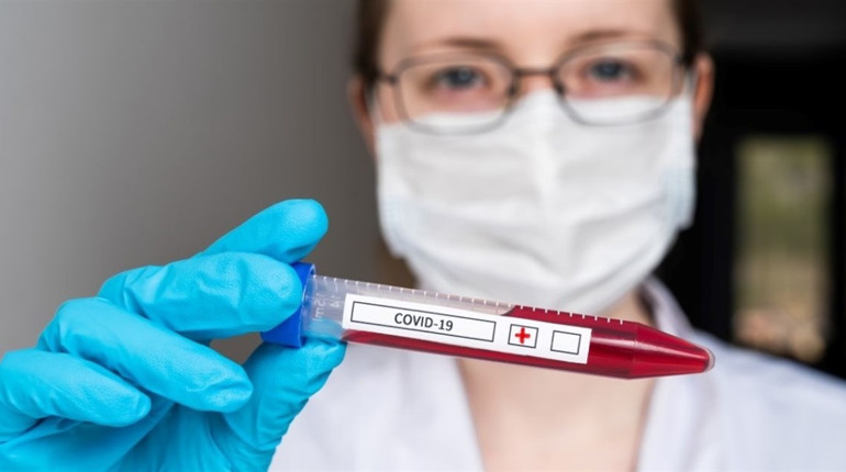 На Сватівщині +58 хворих на COVID-19, п’ятеро померли: яка ситуація з поширенням у громаді і області