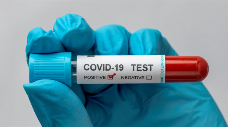 COVID-19 в Україні: яка ситуація з поширенням хвороби у Сватівському районі на ранок 27 січня 2022