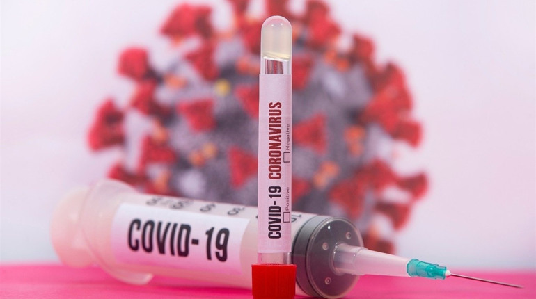 У Луганській області за минулу добу COVID-19 підтвердили у шістьох людей: звідки вони