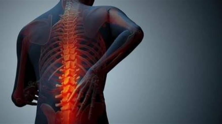 Анкілозуючий спондиліт – коли хребет втрачає рухливість