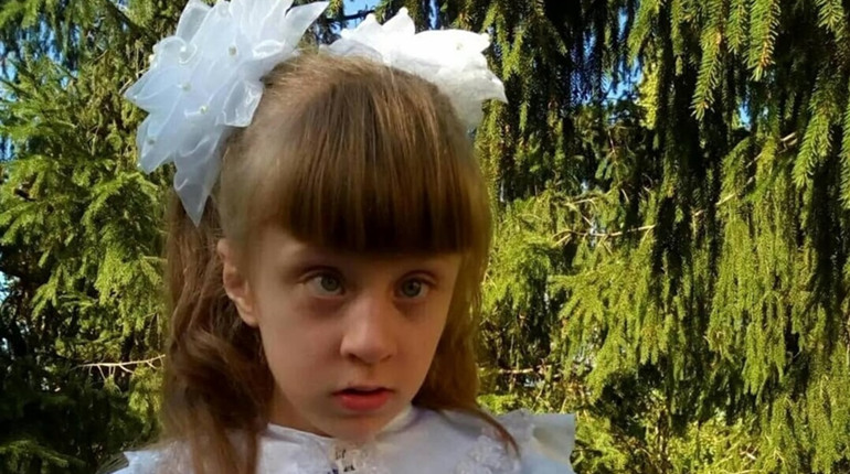 Аня Ковальова зі Сватового вісім років бореться з онкологією: вона пройшла 40 курсів хіміотерапії