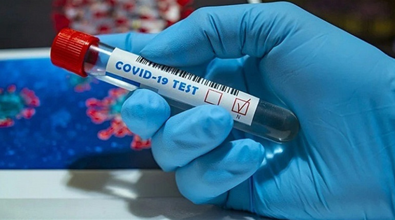 На Сумщині зростає кількість хворих на COVID-19