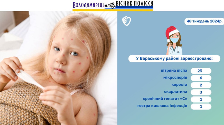 У Вараському районі статистика вітрянки зростає
