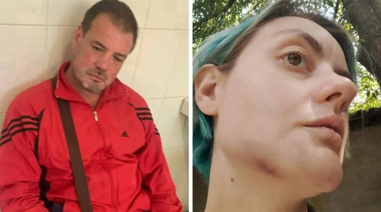Нетверезий працівник ТЦК та СП побив жінку та втік з місця: що відомо про справу