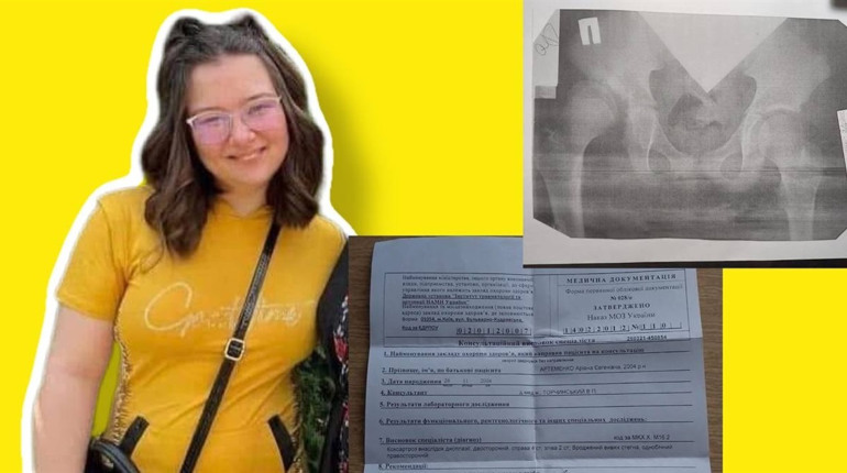 Випускниці Жовтоводського педколеджу терміново потрібна допомога на операцію