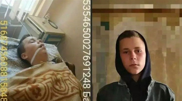В аварії постраждав 17-річний юнак: рідні просять про допомогу