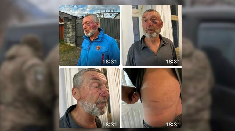 У Сарнах 61-річний майор у відставці потрапив у лікарню: що відомо