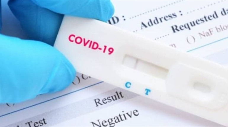 Тестування на COVID-19 може бути безкоштовним: розповідаємо, в яких випадках