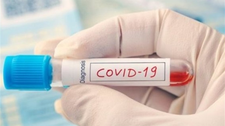На Чортківщині підтвердили 17 нових випадків COVID-19