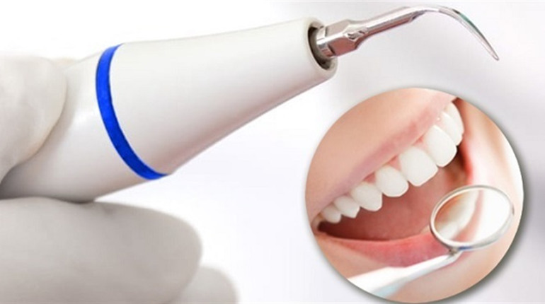 Чи шкодить ультразвукова чистка зубів емалі