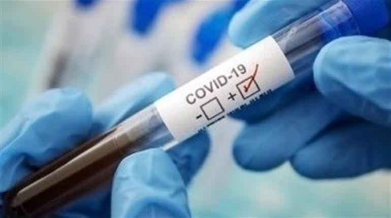За попередню добу на Чортківщині зафіксовано 1 новий випадок COVID-19